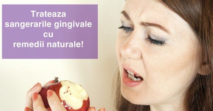 10 remedii naturale pentru sangerarile gingivale