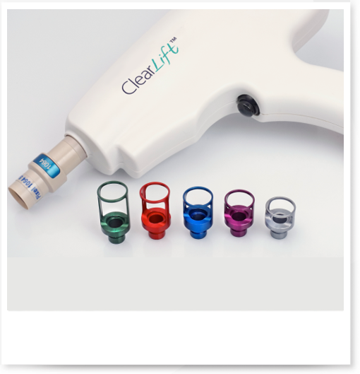 5 motive pentru a procedura de eliminare alunite laser 3