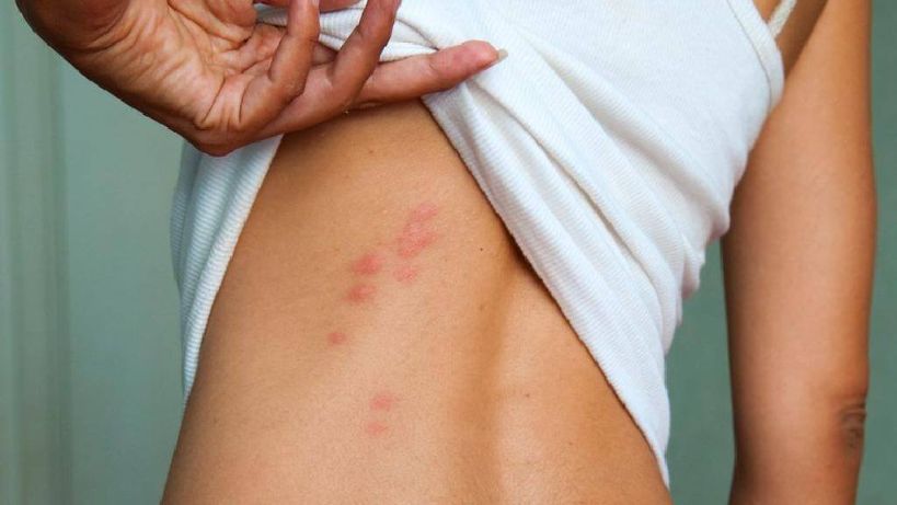 Toate informatiile despre plosnitele de pat de care ai nevoie 1