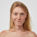 Top 10 remedii naturale pentru inrosirea pielii 1