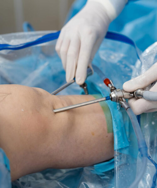 Care sunt cele mai importante avantaje ale artroscopiei?