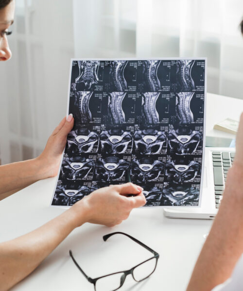 Degradarea Neuronilor în Timp: Cauze și Implicații