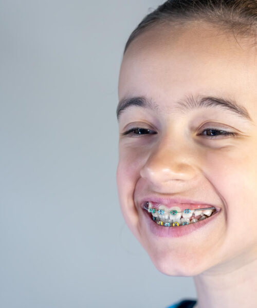 De la ce vârstă este indicat aparatul dentar la copii. Sfaturi de la specialiști