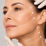 Ce trebuie să știi înainte de un Lifting Facial 2